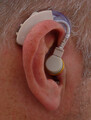 Aaparat słuchowy zauszny klasyczny JH-115 widok w uchu