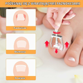 Joycabin zestaw 104 elementów do korekcji wrastających paznokci – zdjęcie 3