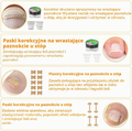 Joycabin zestaw 104 elementów do korekcji wrastających paznokci – zdjęcie 6