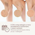 Philips Lumea seria 9000 BRI955/00 – depilator IPL z aplikacją, 3 nasadki – zdjęcie 4